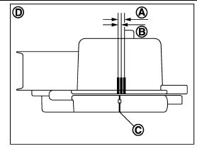 tensioner